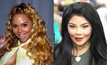 10x celebs plastic surgery gone bad!