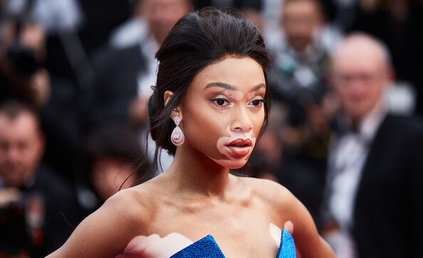 Supermodel Winnie Harlow deelt prachtige naakte selfie met een krachtige  boodschap