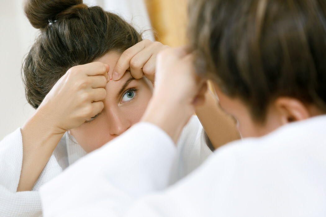 Dit zijn de beste producten om te gebruiken voor je gezicht als je acne hebt