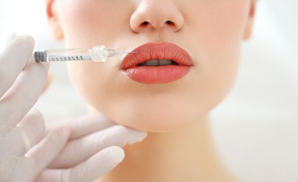 De grootste fabels over lip fillers die je nog gelooft