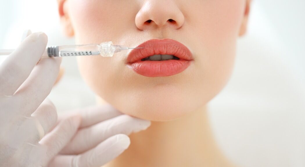 De grootste fabels over lip fillers die je nog gelooft