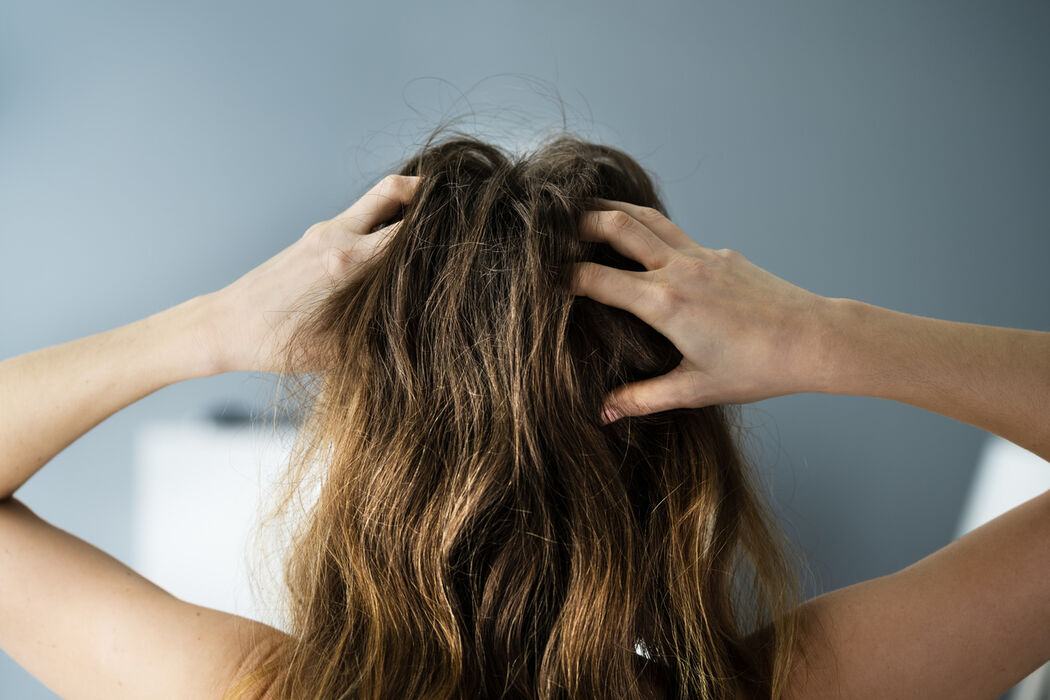 Dit zijn effectieve tips tegen roos in je haar tijdens de winter