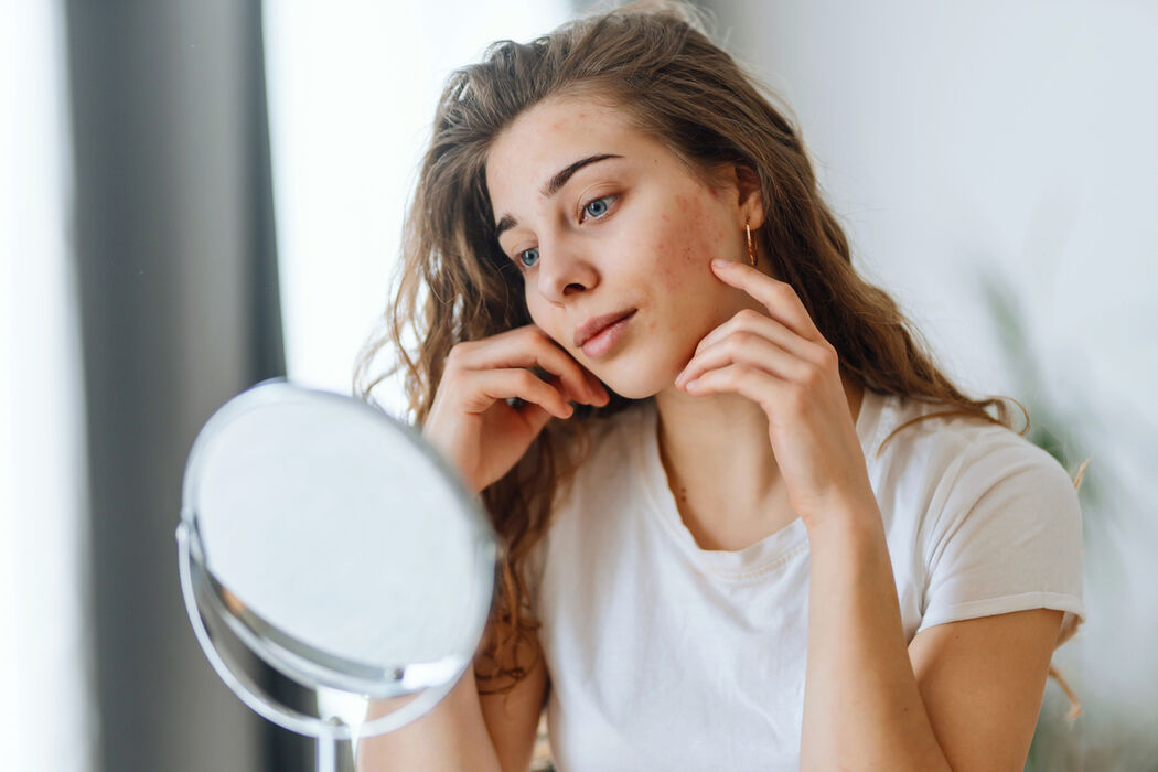 Ceramiden zijn onmisbaar in een skincare routine voor de droge huid: dit is hoe je dit ingrediënt gebruikt